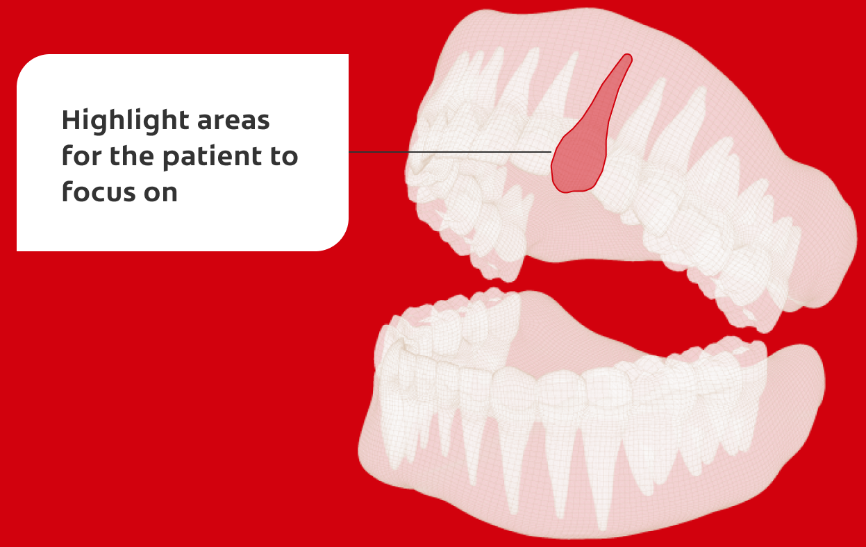 Highlight areas for the patient to focus on