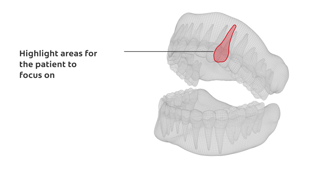 Highlight areas for the patient to focus on