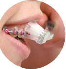 Protecteur buccal sur broches roses pour sports de contact.