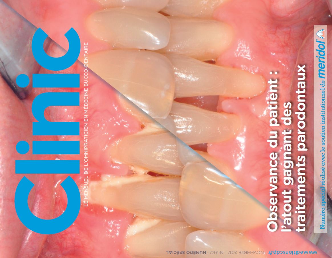 Observance du patient : l’atout gagnant des traitements parodontaux - CLINIC Novembre 2017