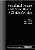 Article-PeriodontalDiseaseGuide