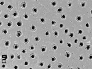 Microscopic view of open dentin tubules in human tooth structure, showing porous surface responsible for tooth sensitivity.